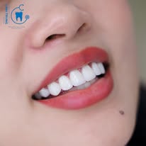 Nha Khoa Thẩm Mỹ Tại Thủ Đức – Thiết Kế Nụ Cười Hài Hòa, Tự Nhiên