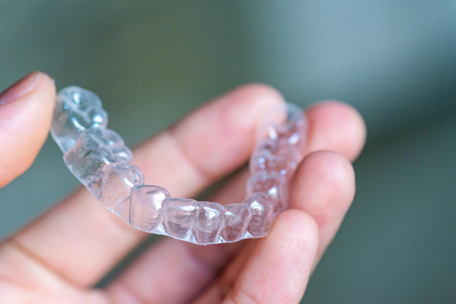 nien rang Invisalign