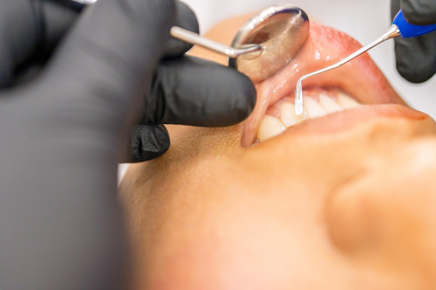 nha khoa tong quat 2